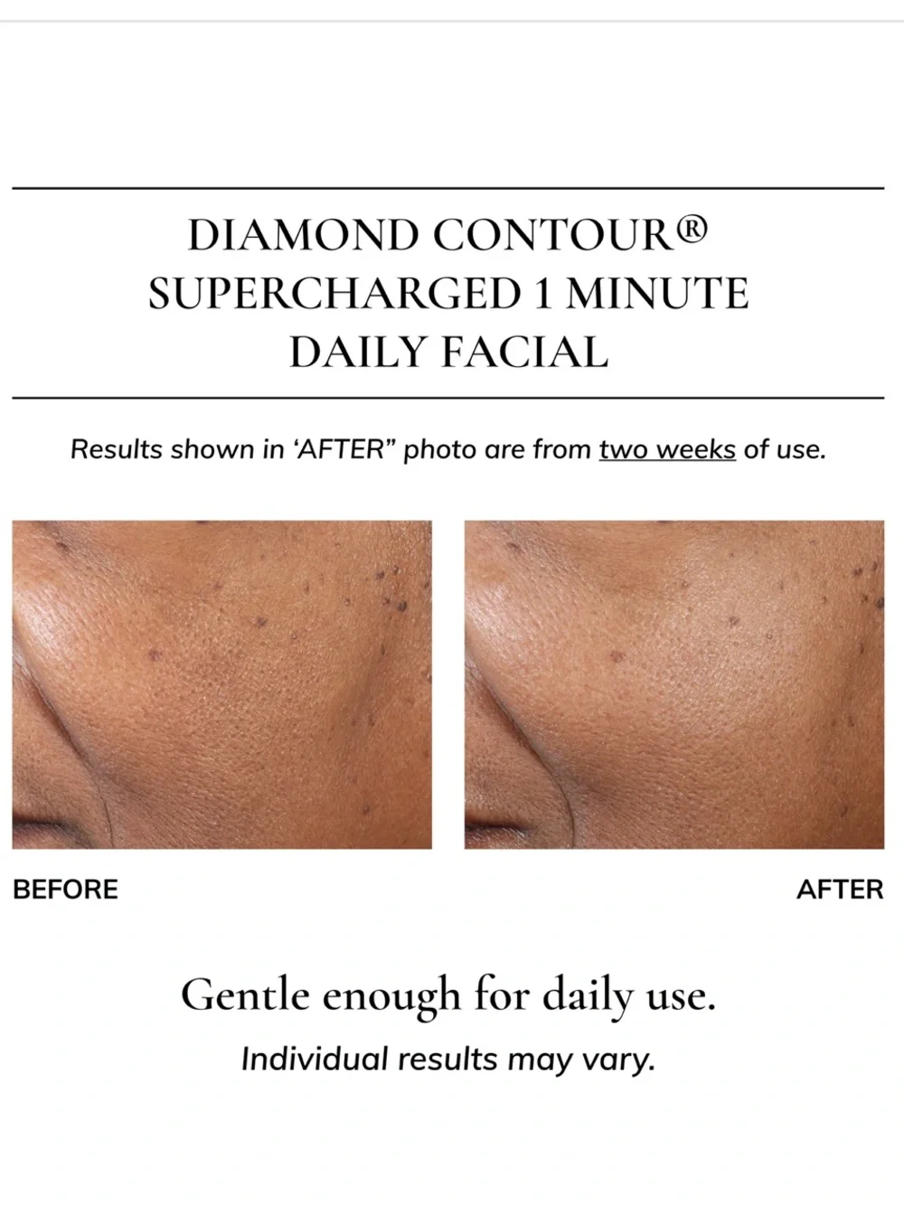 Kaplan MD Diamond Contour Supercharged 1 Minute Daily Facial 3oz/90ml